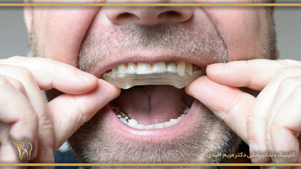 دندان قروچه و روش درمان آن