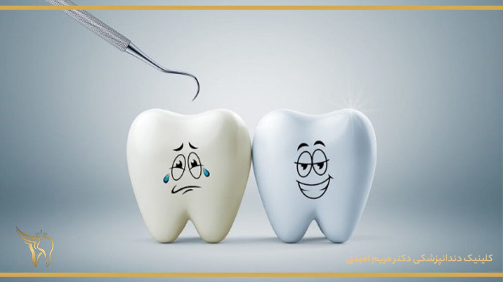 درمان حساسیت دندان