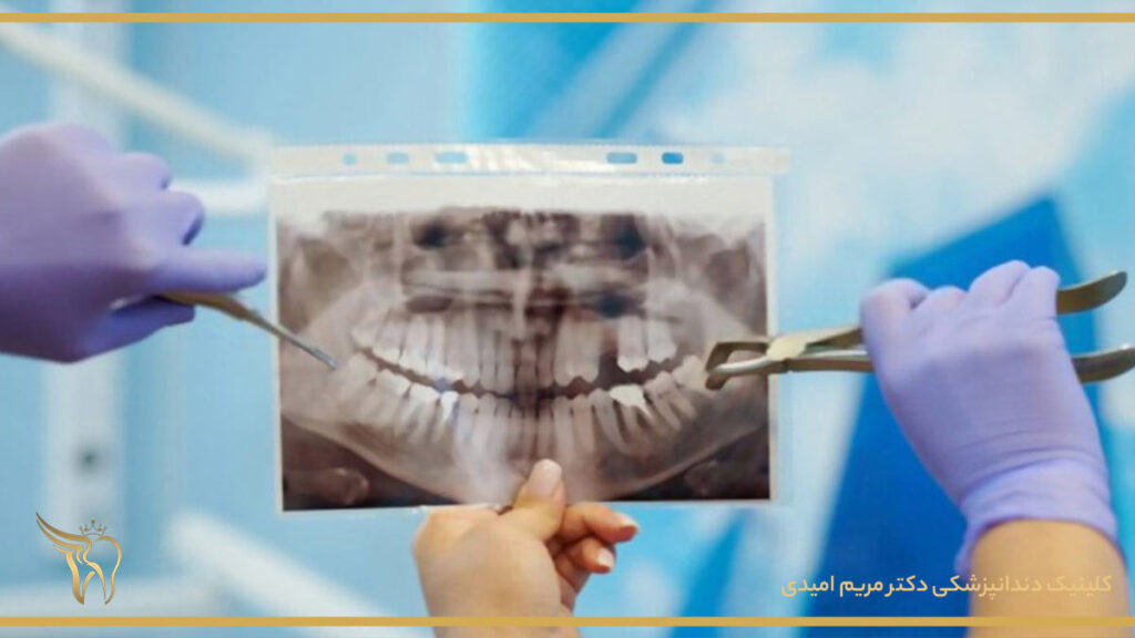 خطرات عکس رادیوگرافی دندان