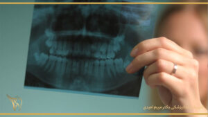 خطرات عکس رادیوگرافی دندان
